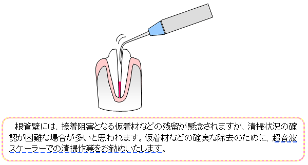 image-20220513162837-2