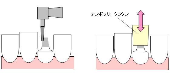 image-20220513162944-7