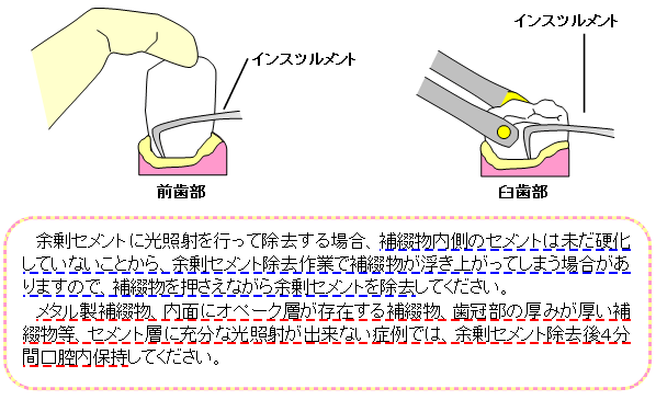 image-20220513171138-7