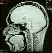 image-20220514173245-3