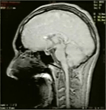 image-20220514173300-4