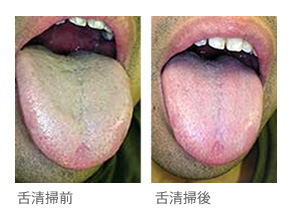 口臭