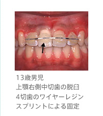 口臭