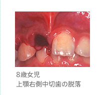 口臭