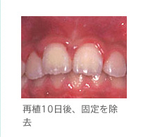 口臭