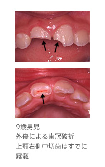 pic 12