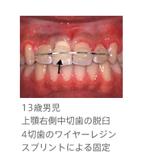 pic 13