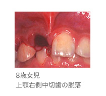 pic 14