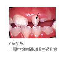 pic 16