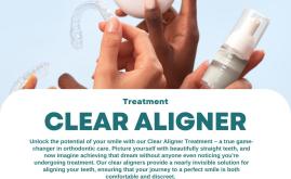 Clear Aligners